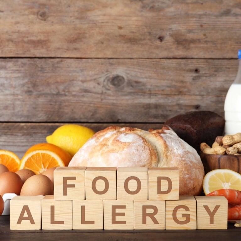 Blocks spelling FOOD ALLERGY with eggs, bread, nuts, milk, and oranges behind them.